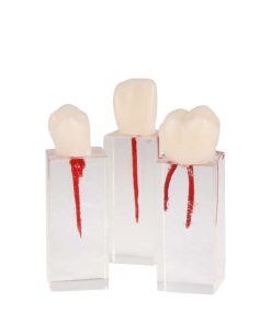 Set de Dientes Endo para práctica dental